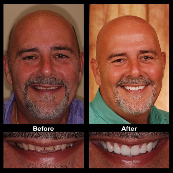 teeth restoration dentist